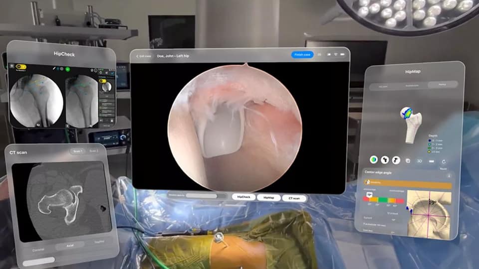 Surgeons keep finding reasons to use the Apple Vision Pro